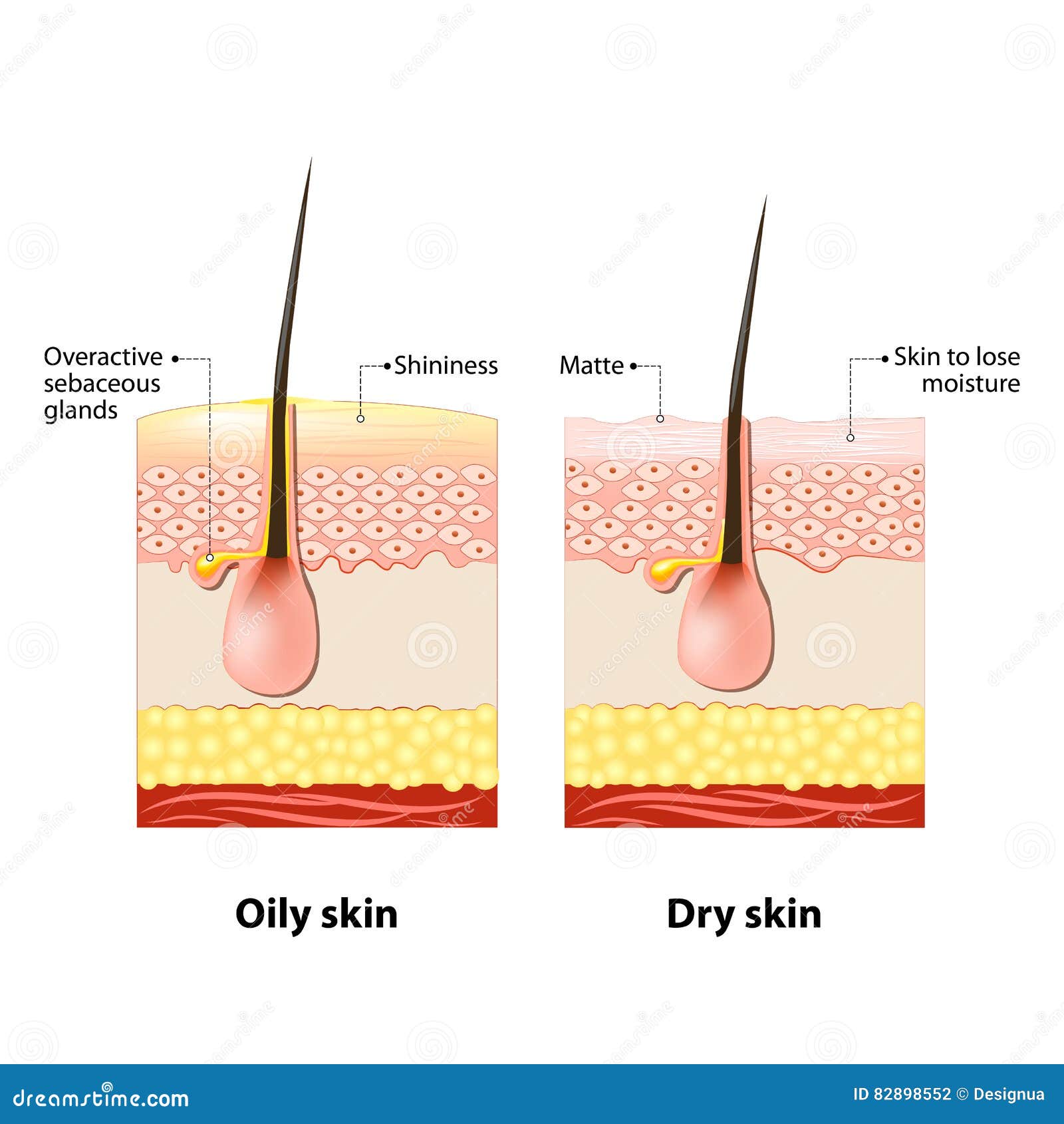 oily & dry skin