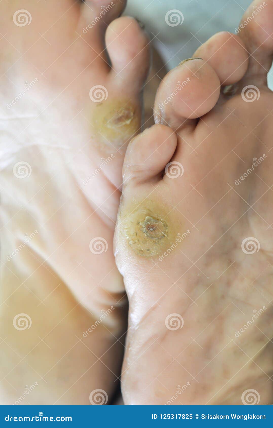 Old Foot Soles in Old Women Stock Image - Image of health, foot