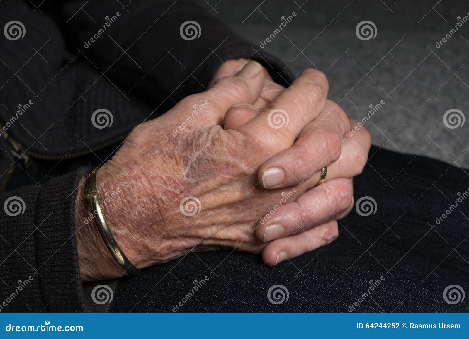 old lady hands with arthritis