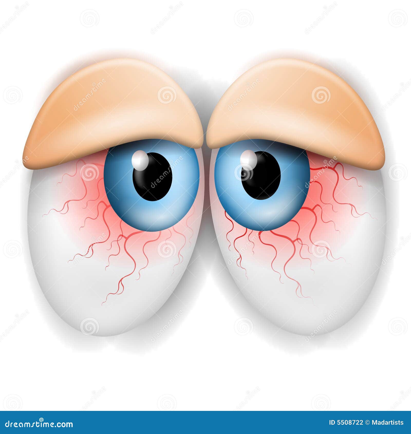 Olhos Bloodshot Tired Droopy Ilustração Stock Ilustração de sangue