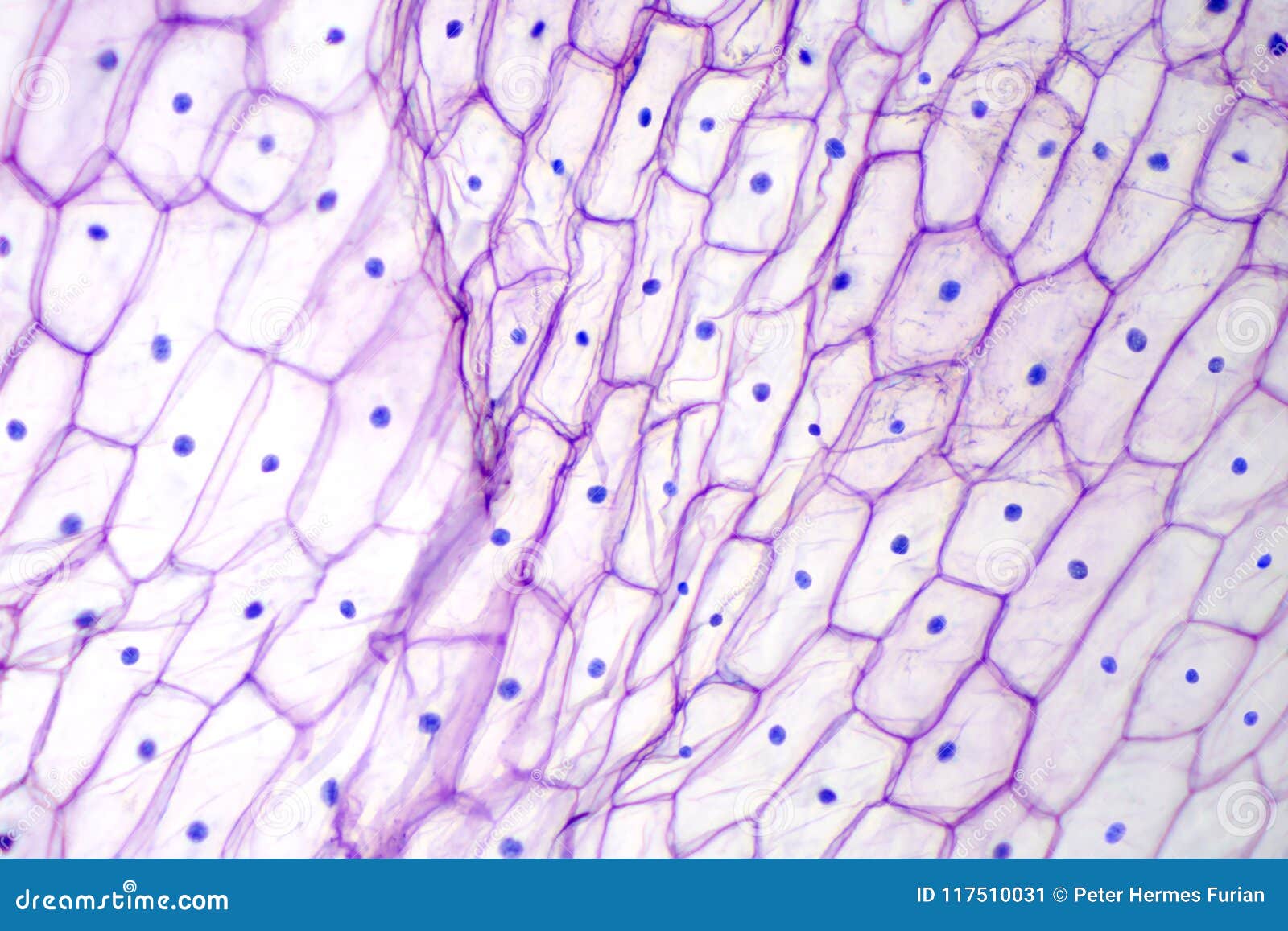 onion epidermis with large cells under microscope