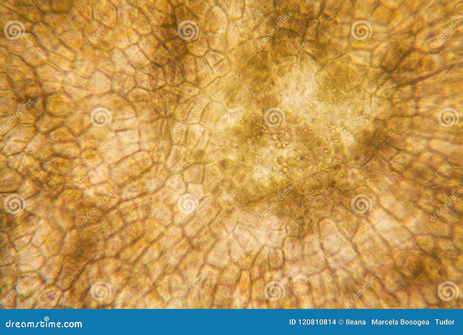 Onion Root Cells at the Microscope Stock Photo Image of meiosis, cell