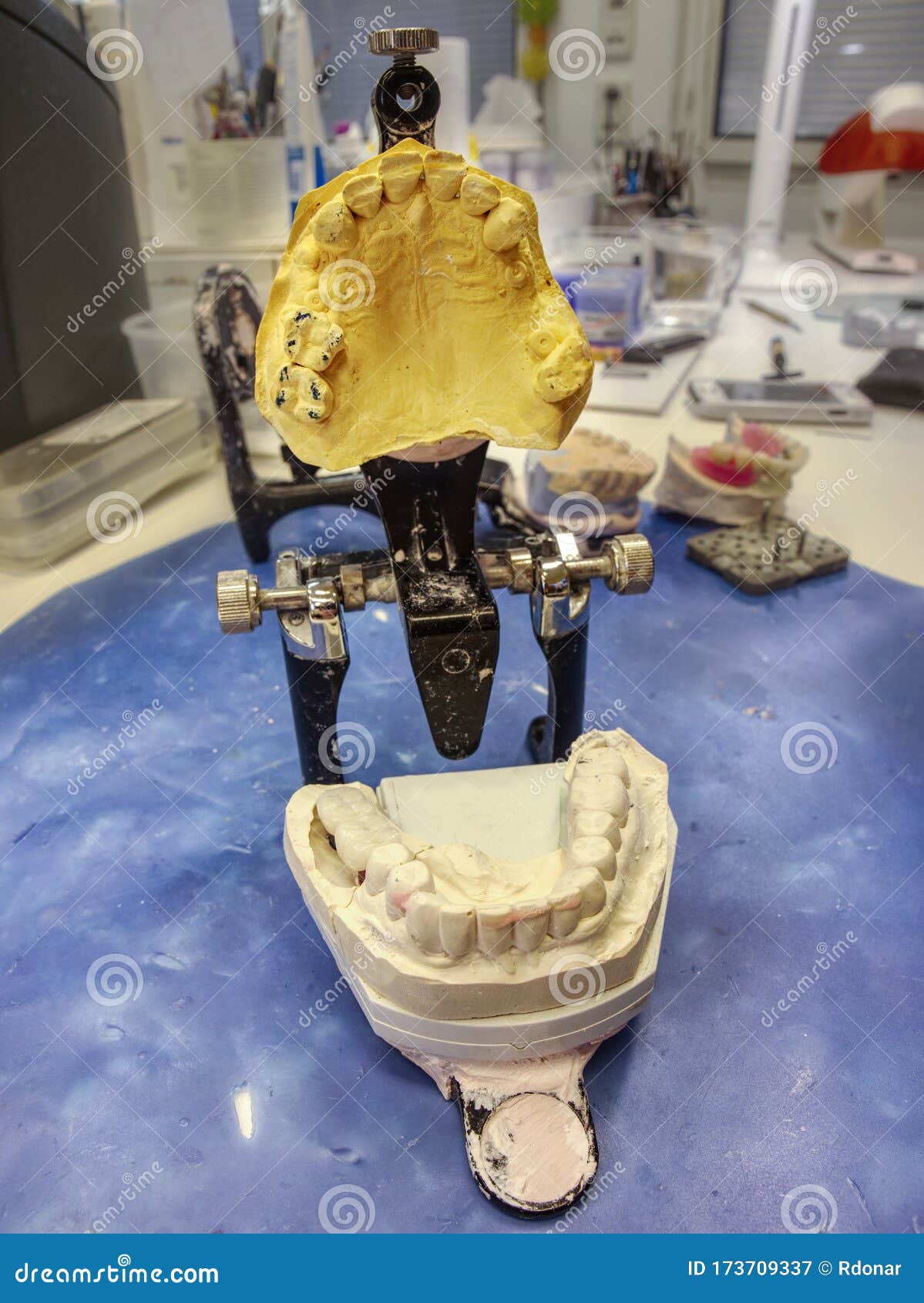 Open Mouth Articulator with Teeth Models in Lab Stock Image Image of