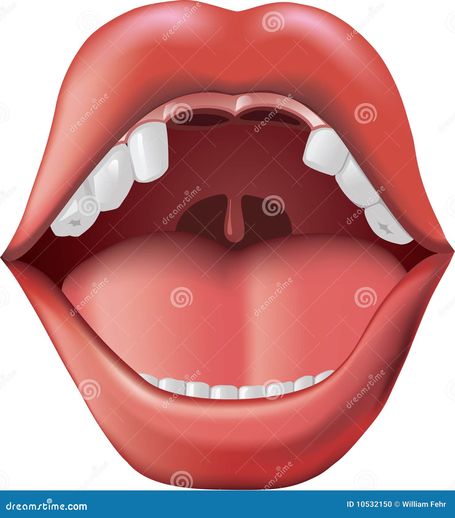 All Missing Teeth - Removable Full Denture Royalty-Free Cartoon