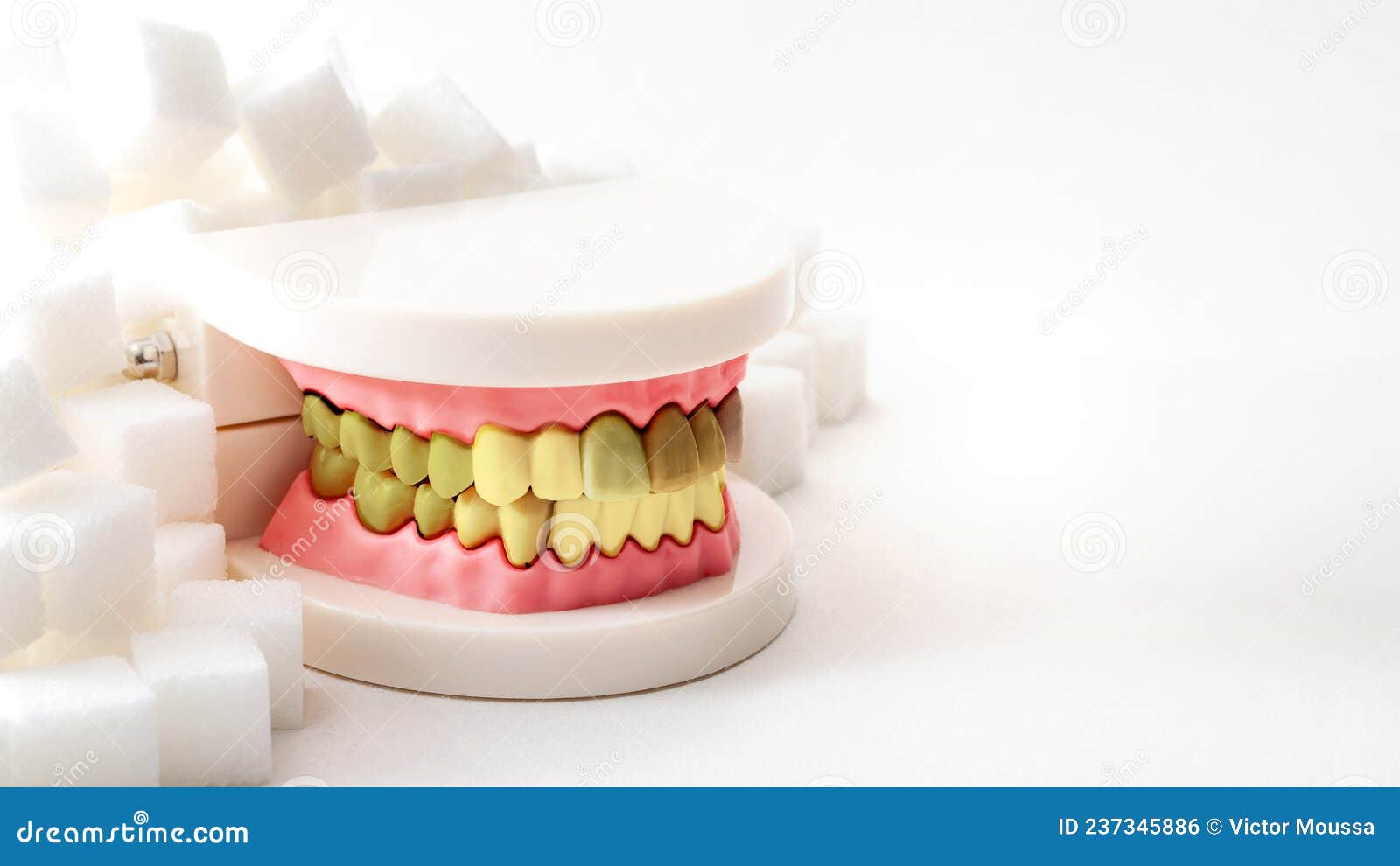 oral health, tooth decay and cavities and sugary foods destroy the dental enamel concept with plastic medical model of cavity