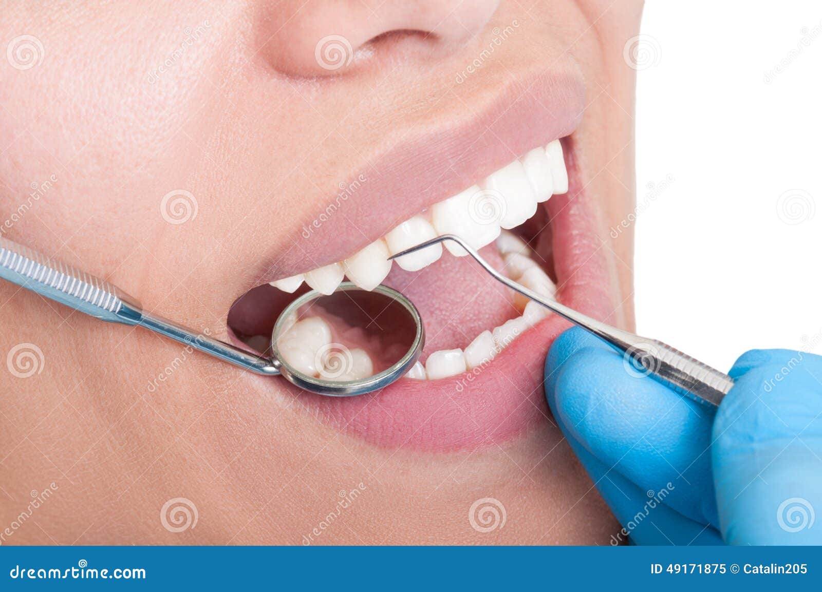 oral hygienist at work