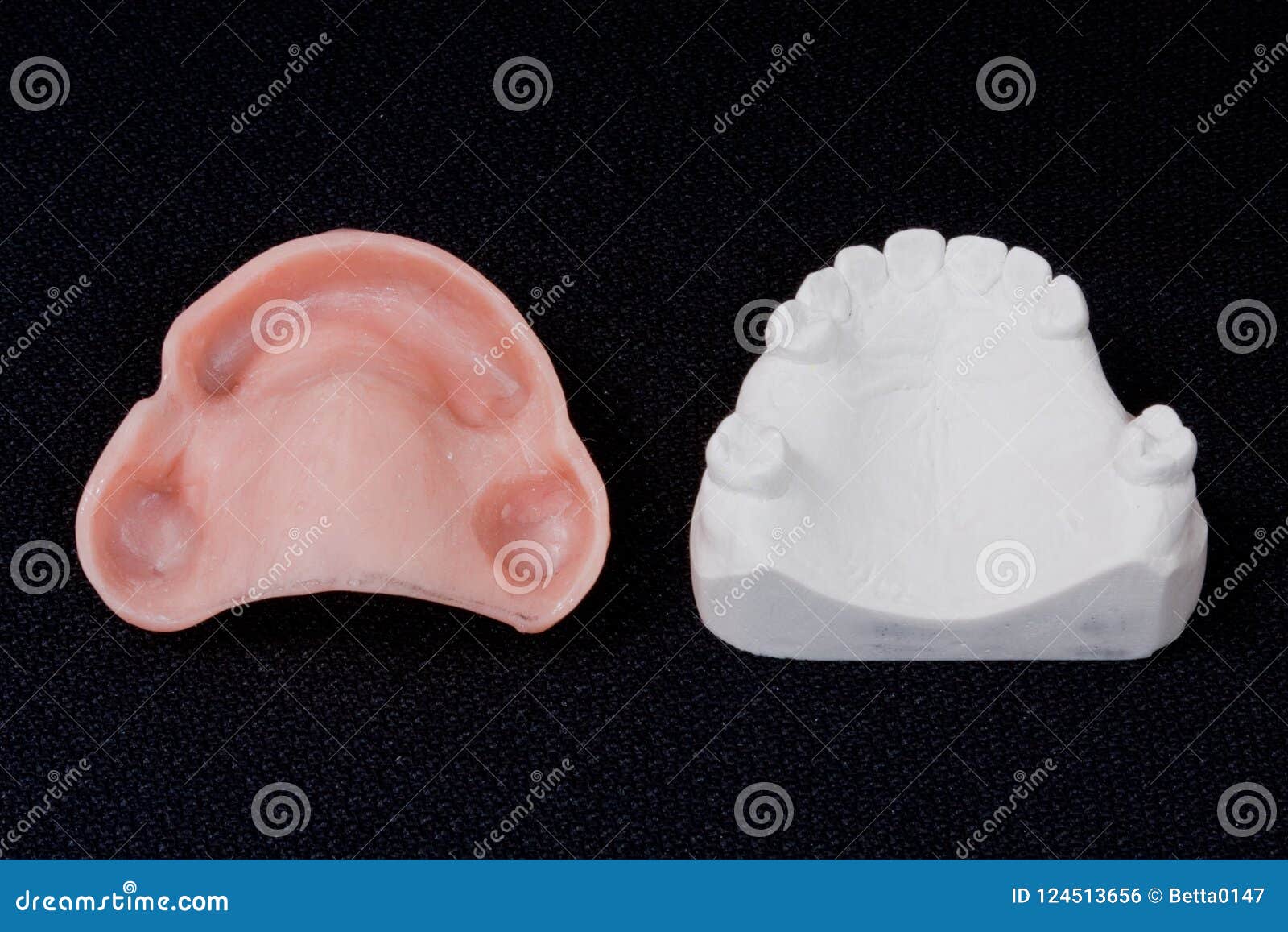 Oral Rehabilitation Process, Partial Removable Prosthesis Stock Photo