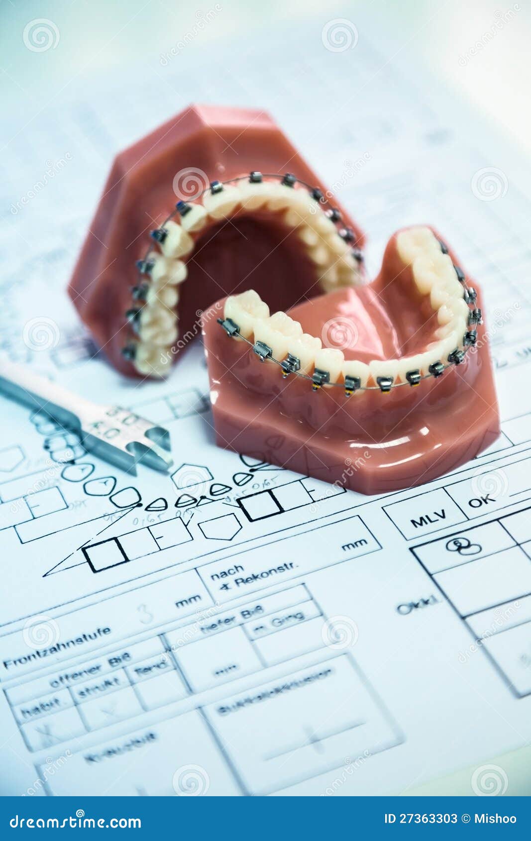Ortho tools stock image. Image of health, hygiene, gypsum 27363303