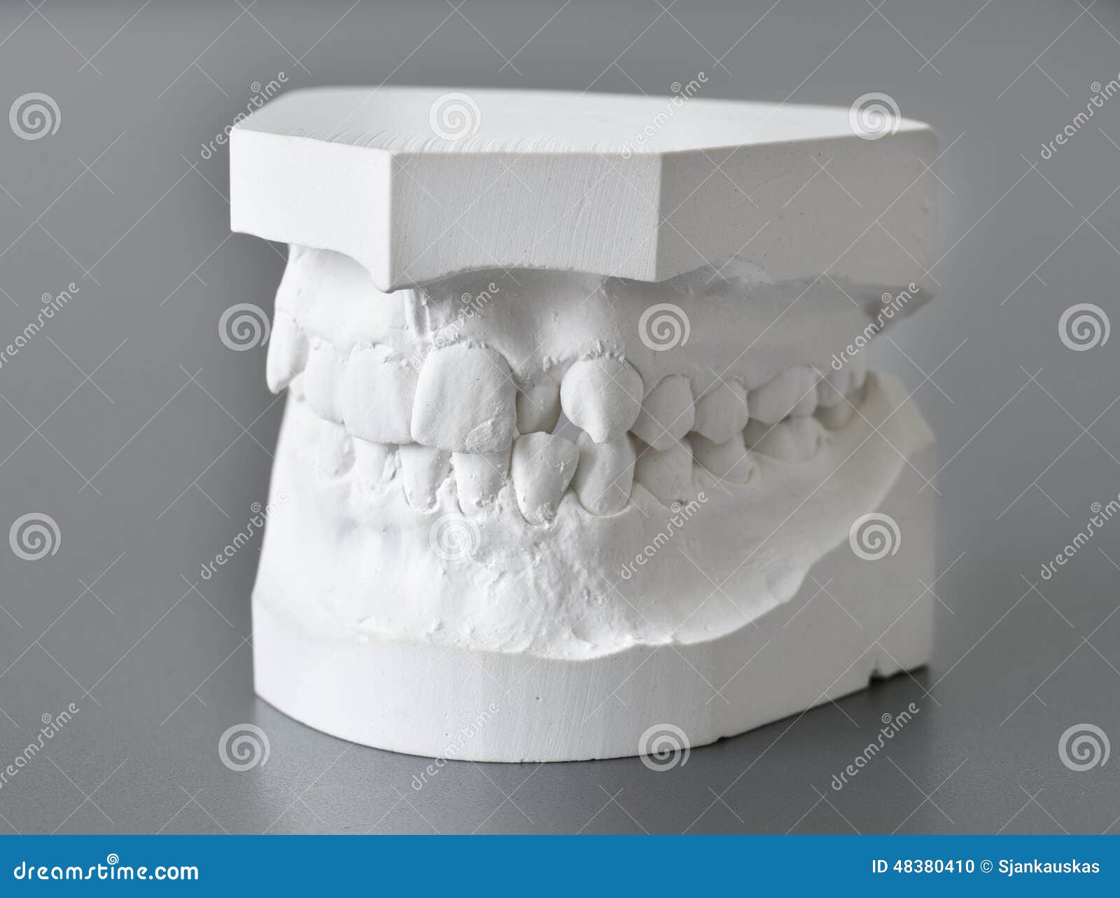 Orthodontic Molds Dental Correction Stock Photo Image of clear