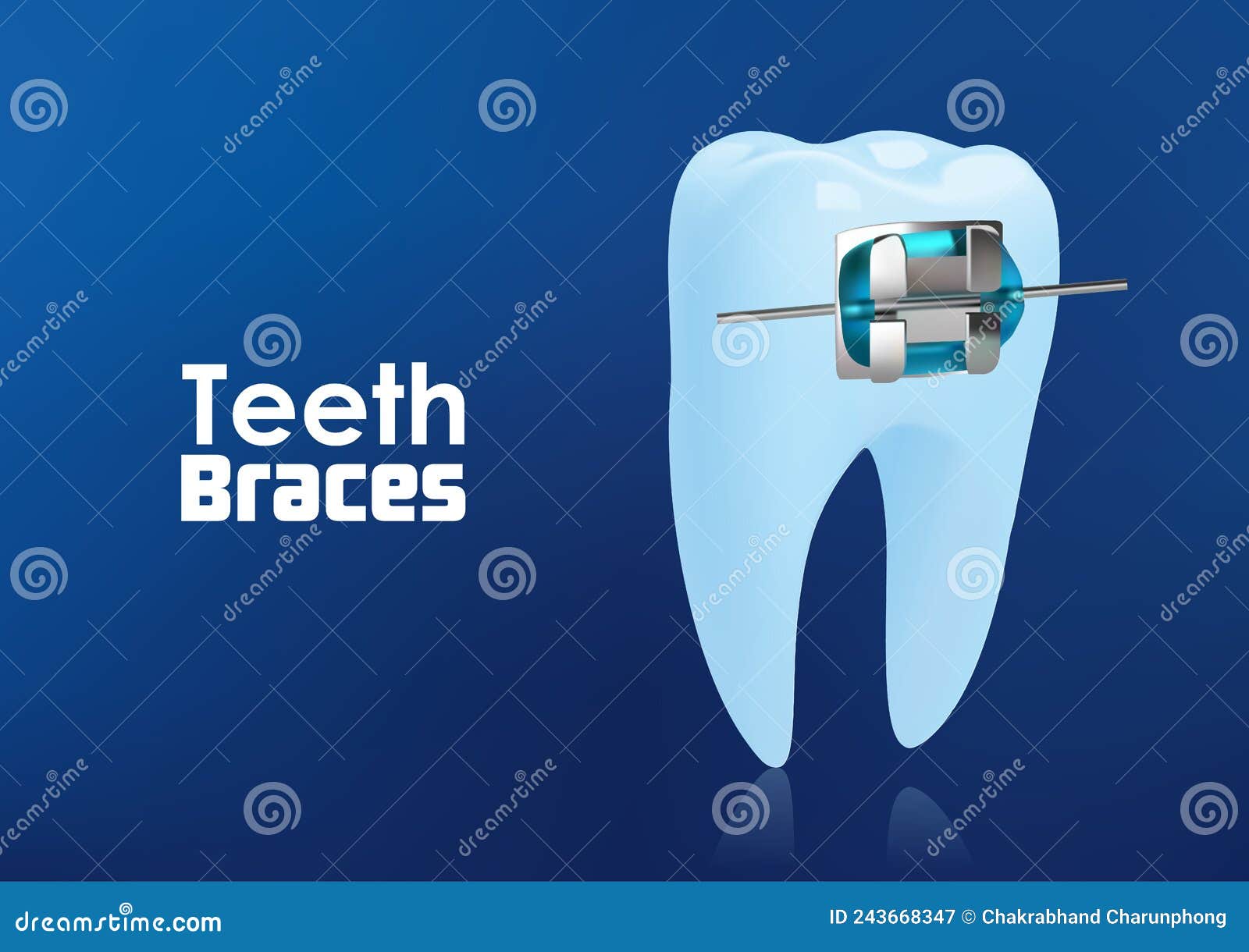 Orthodontic Teeth or Dental Braces Concept . Illustration Vector Stock