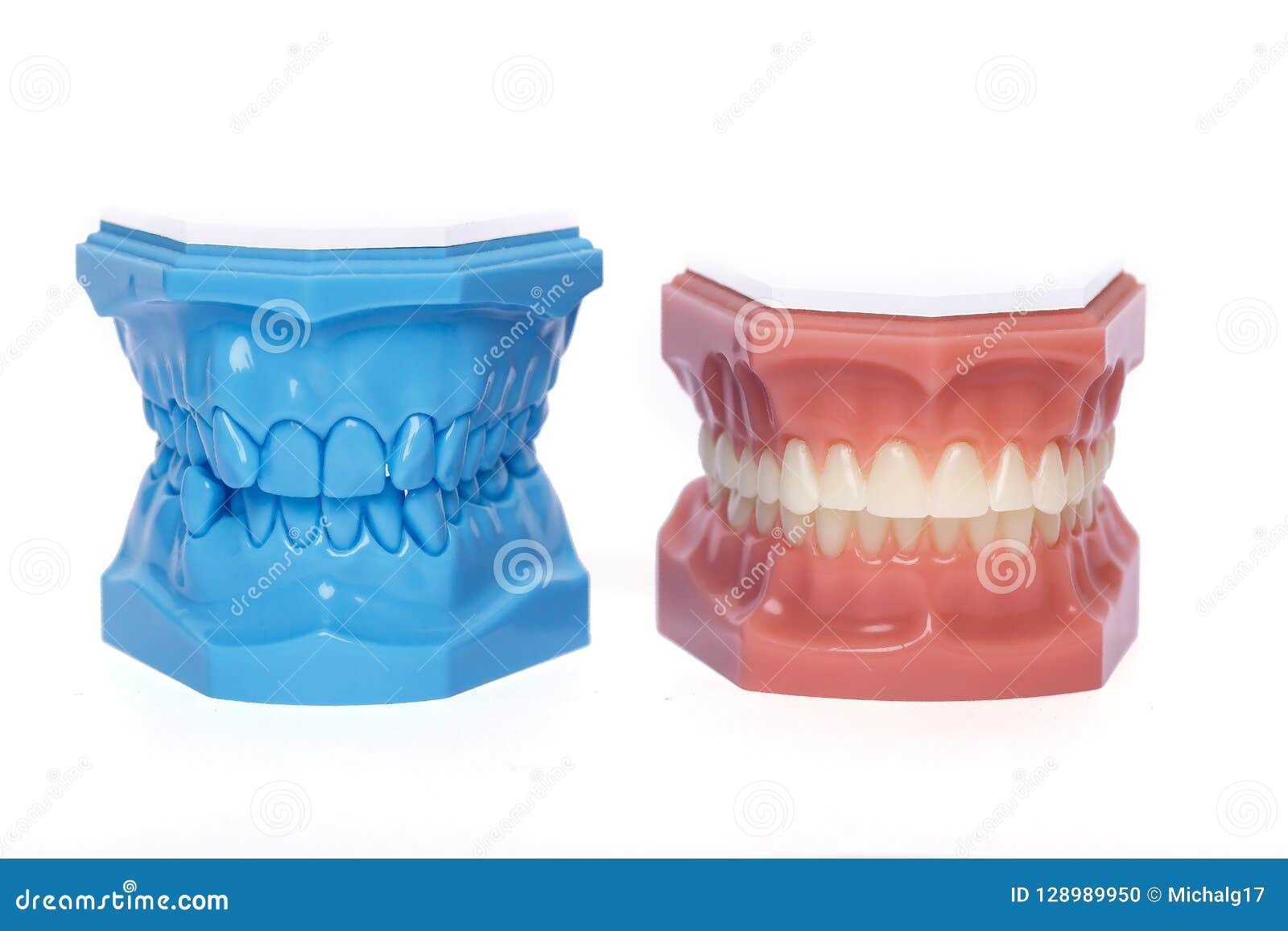 Orthodontic Teeth Models Used in Dentistry Stock Photo Image of