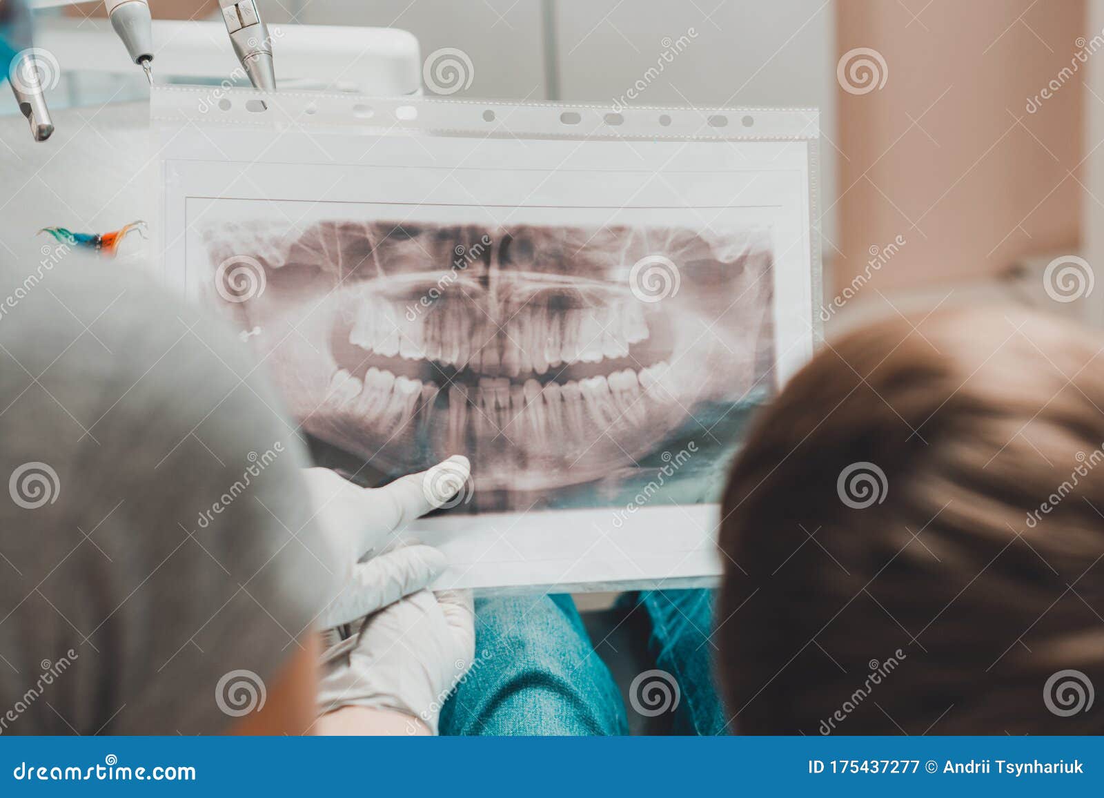 An Orthodontist Doctor Shows the Boy an Xray of His Teeth Stock Image