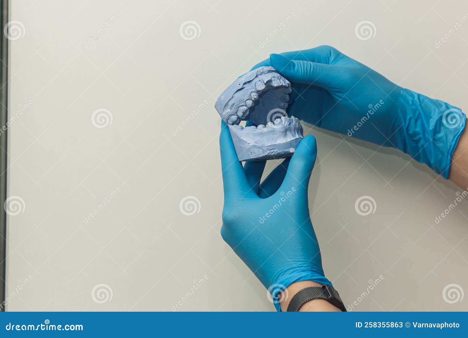 The Orthodontist Holds in His Hands and Examines the Cast of the Jaw