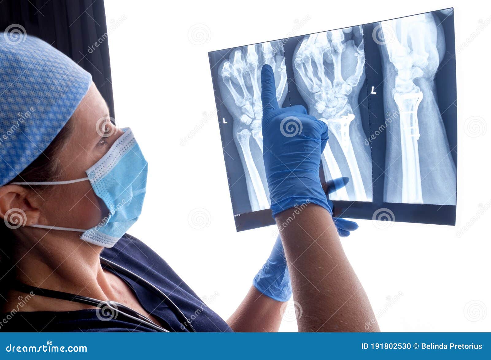 orthopaedic surgeon studying a x-ray of a broken radius bone in theatre after correctional surgery