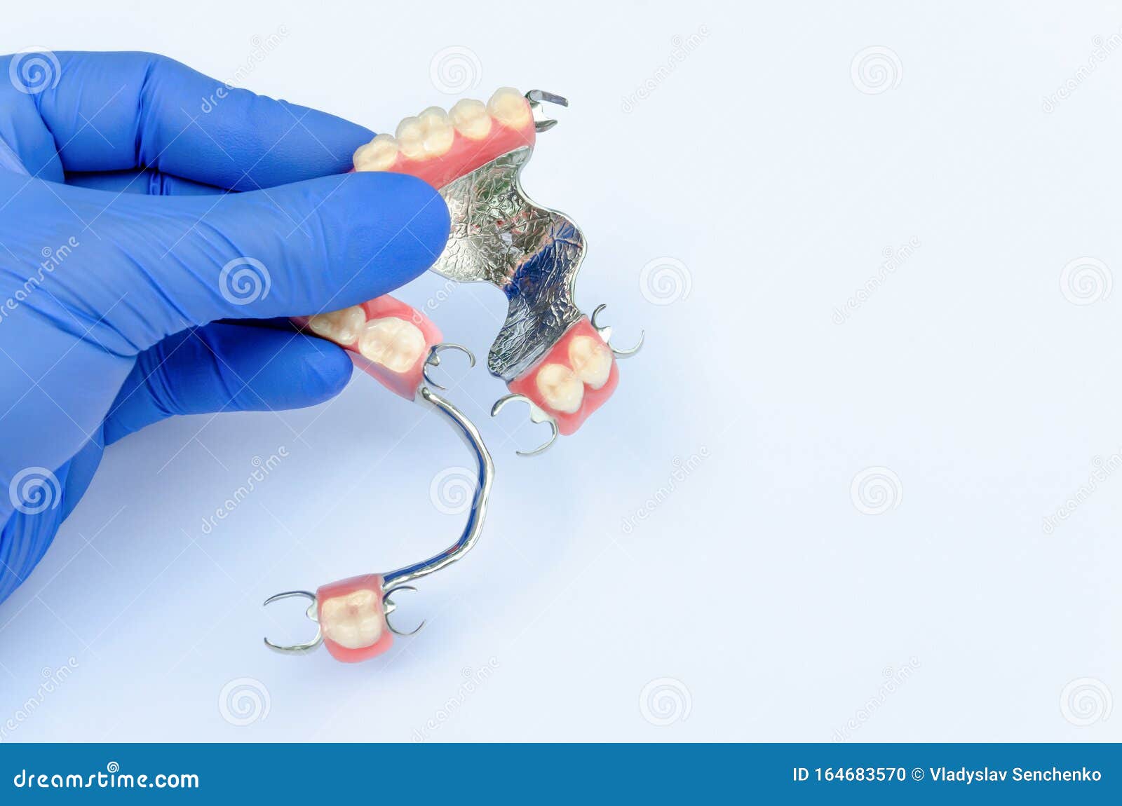 orthopedic dentistry. prosthetics concept with removable dentures. a dentistÃ¢â¬â¢s hand in a glove holds a set of clasp prostheses