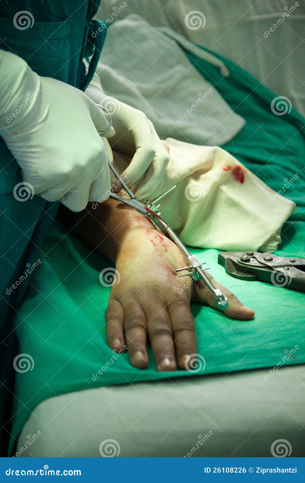 Orthopedic surgery 6 stock photo. Image of busy, operating ...