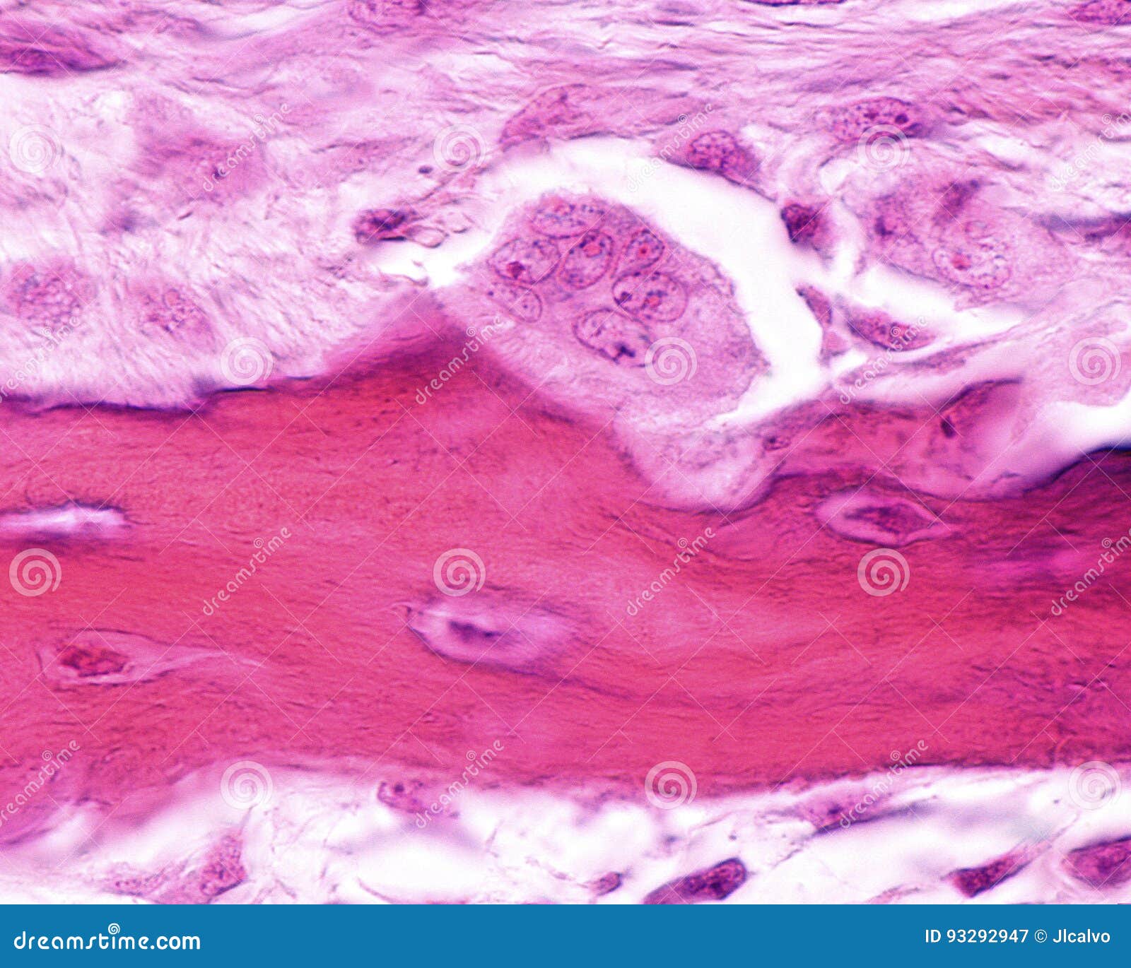 Osteoclast. Howshipâ€™s Lacuna Stock Image Image of osteoclast, cell