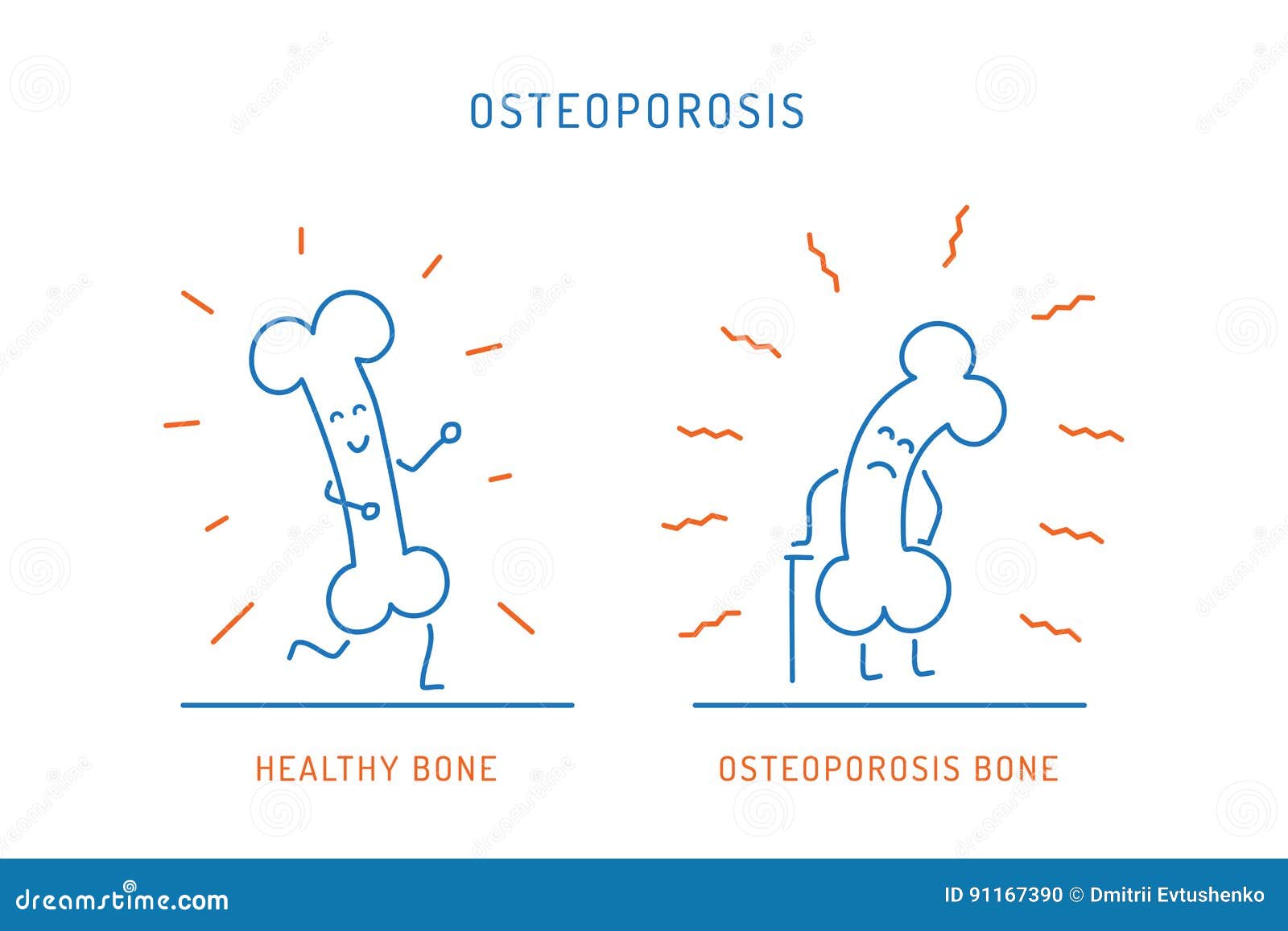 Osteoporosis cartoon bone stock vector. Illustration of condition - 91167390