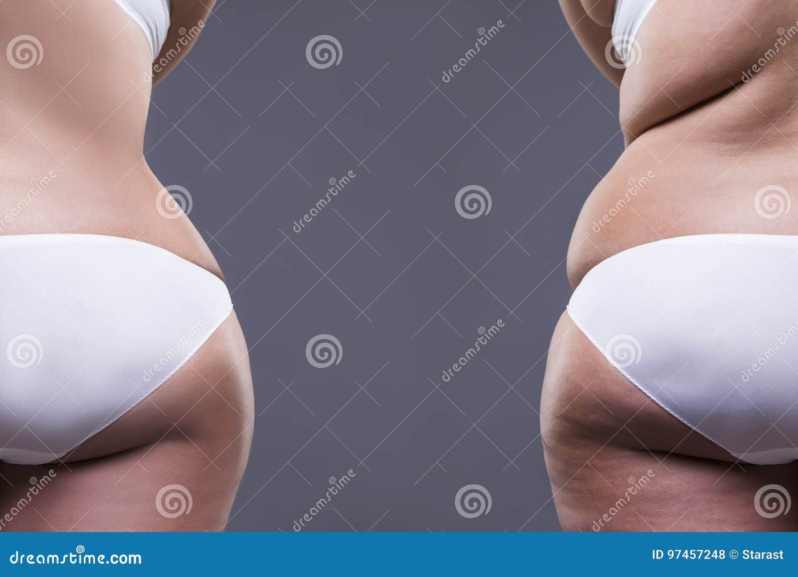 overweight woman with fat legs and buttocks, before after concept, obesity female body, rear view