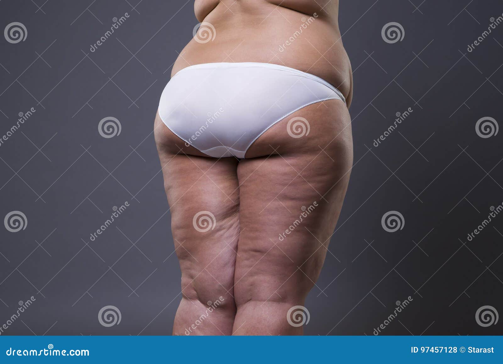 13,780 Fat Legs Stock Photos - Free & Royalty-Free Stock Photos