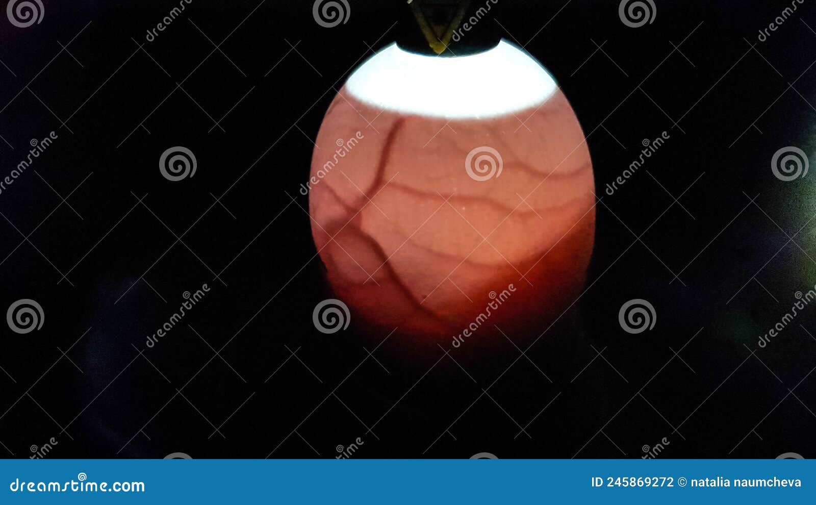 Ovoscopy of a Chicken Egg. an Embryo Inside an Egg. Incubation in an