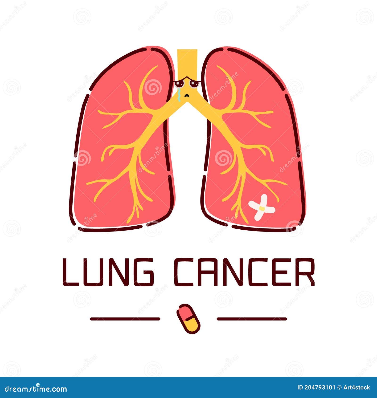 Póster De Dibujos Animados Sobre El Cáncer De Pulmón Ilustración del Vector - Ilustración de quimioterapia, aire: 204793101 Póster De Dibujos Animados Sobre El Cáncer De Pulmón Ilustración del Vector - Ilustración de quimioterapia, aire: 204793101