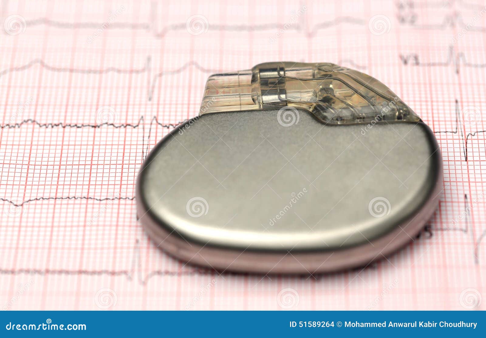 pacemaker on electrocardiograph