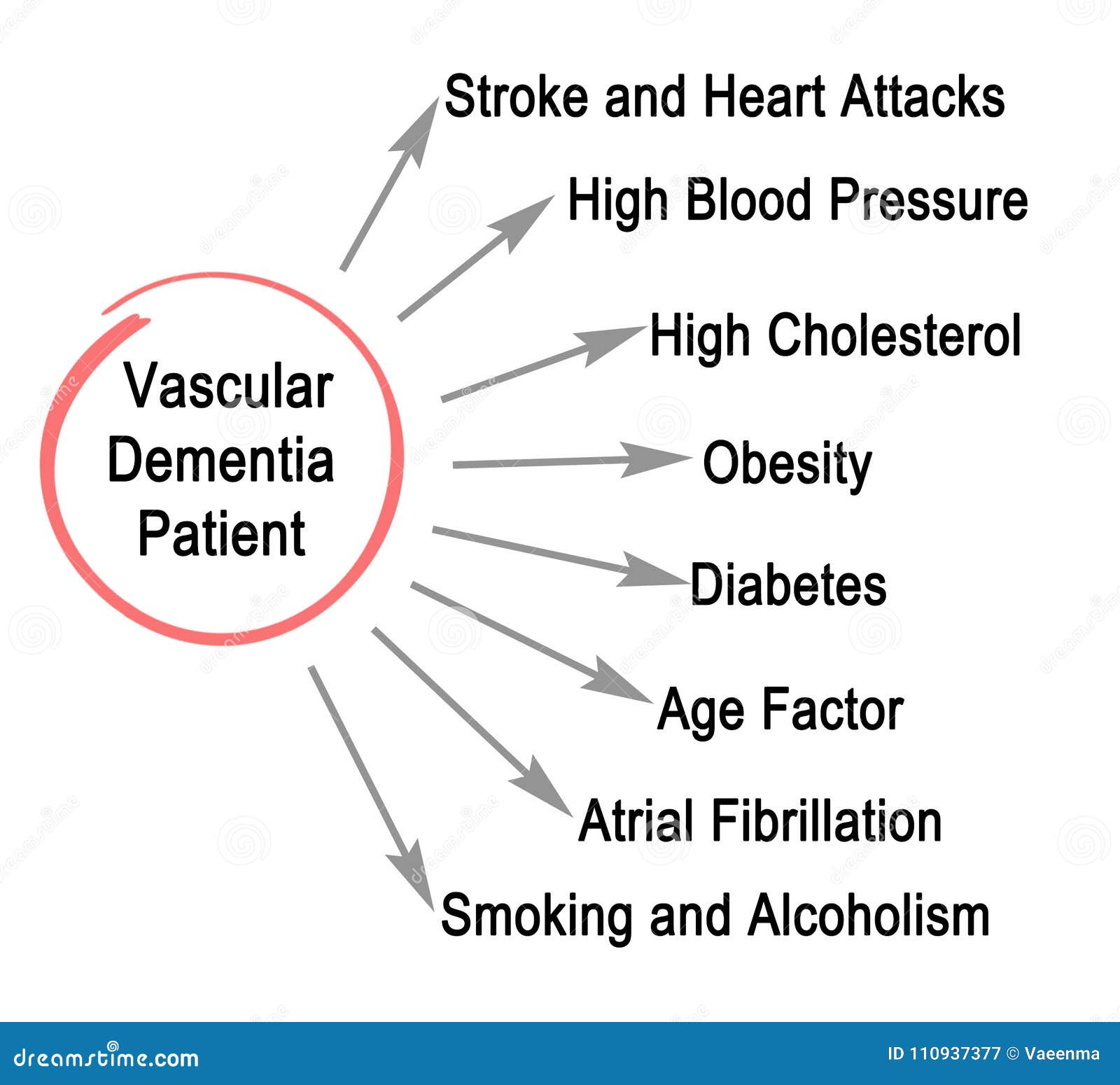 Paciente Vascular De La Demencia Stock de ilustración Ilustración de
