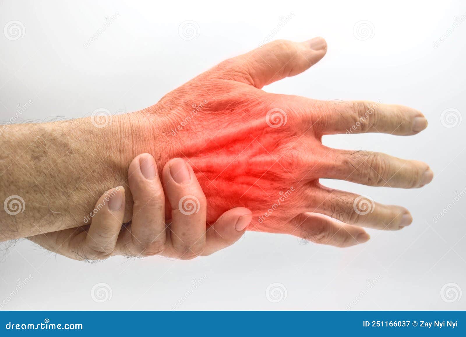 Pain in Hand of Asian Man. Concept of Hand Pain, Tendinitis and Joint