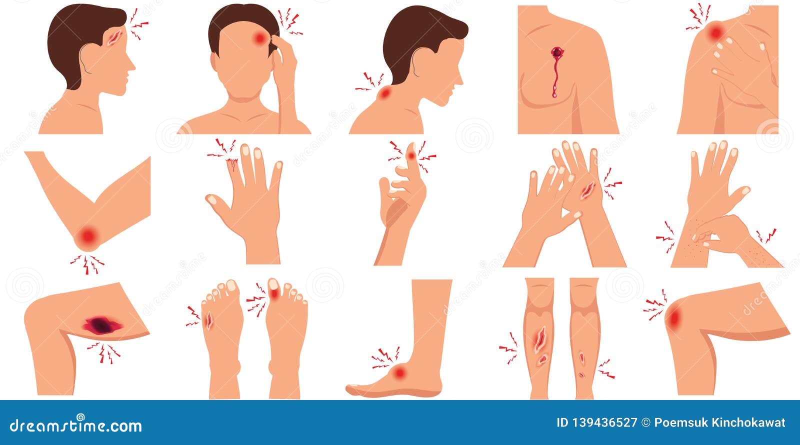 Pain In The Human Body Parts Physical Injury Flat Set Stock Vector Illustration Of Design Massage 139436527