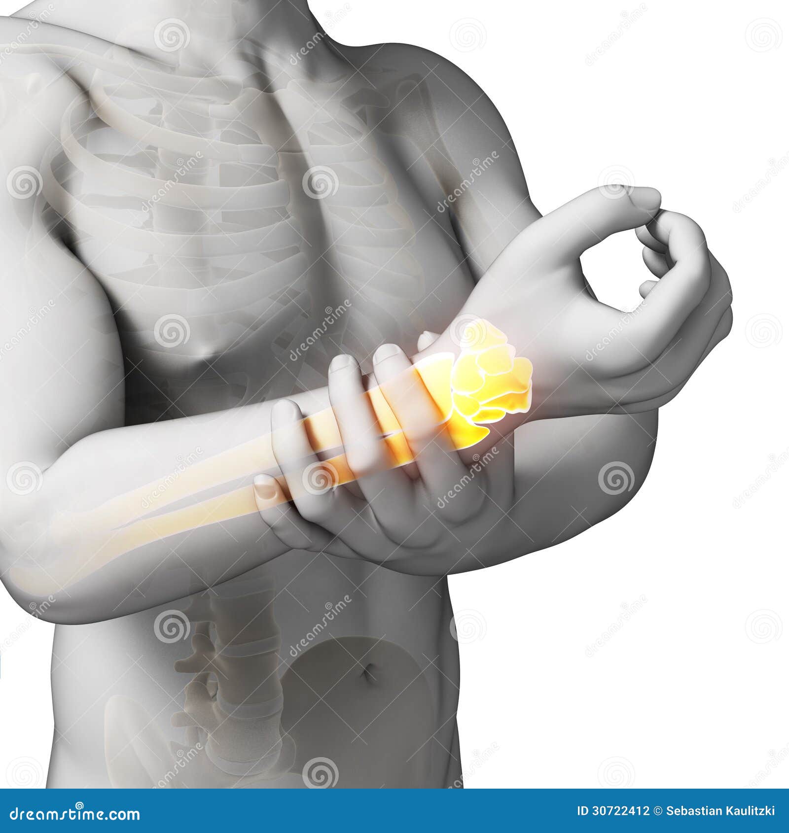 Painful arm stock illustration. Illustration of health 30722412