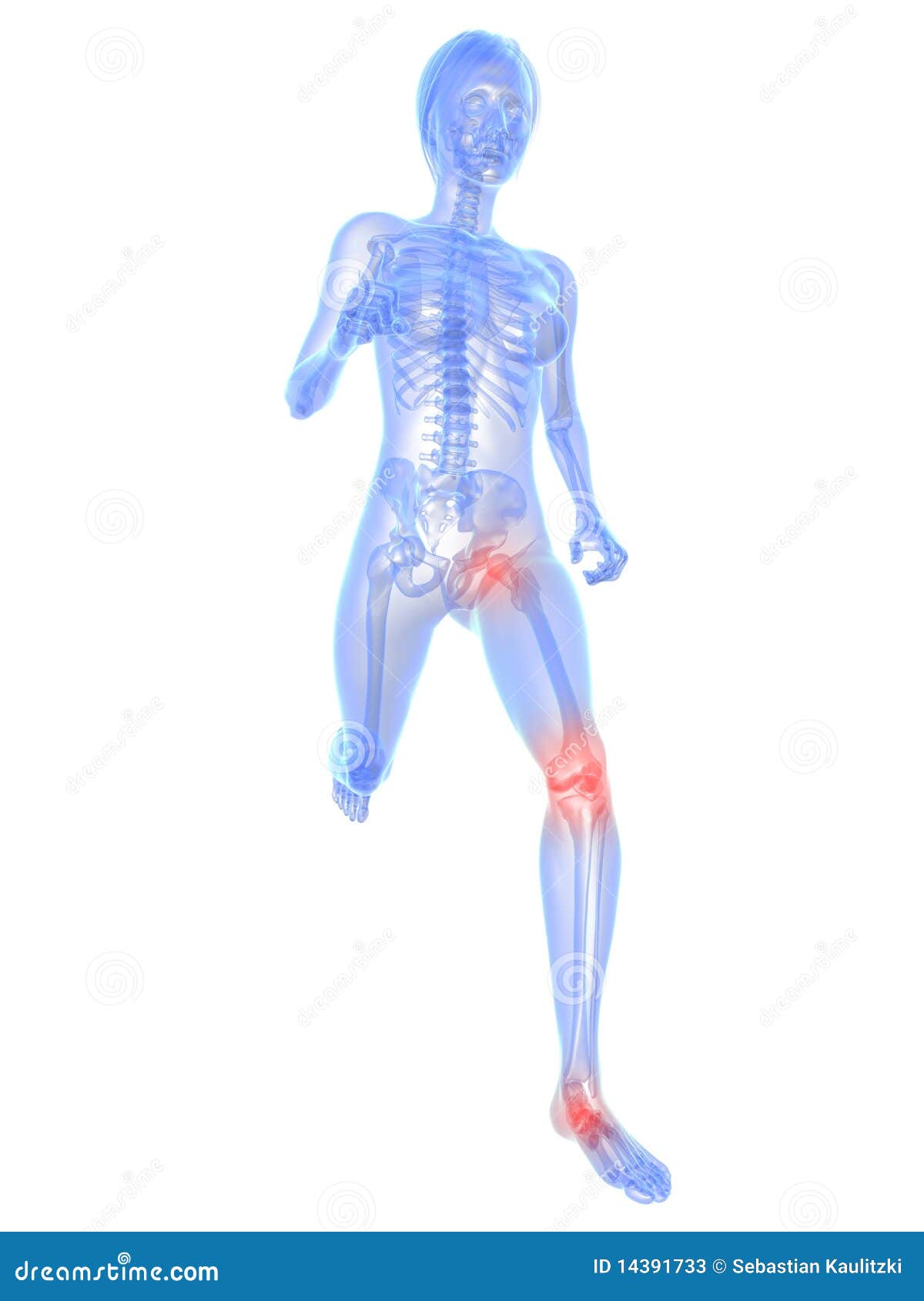 Painful knee and hip stock illustration. Illustration of knee 14391733