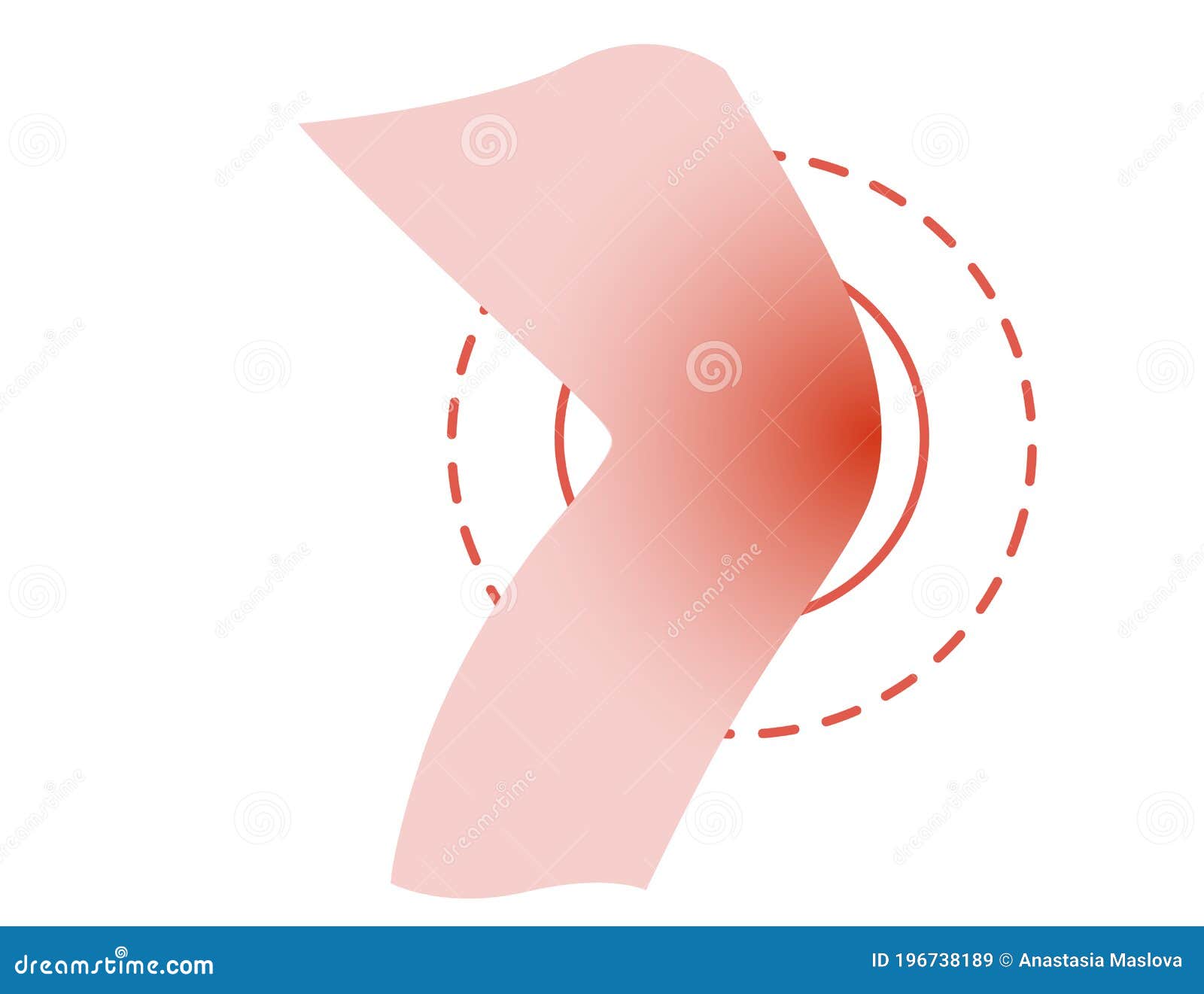 Painful Leg Knee Concept with Pain Red Circle Cartoon Flat Design Vector  Illustration on White Background Stock Illustration - Illustration of  massage, bone: 196738189