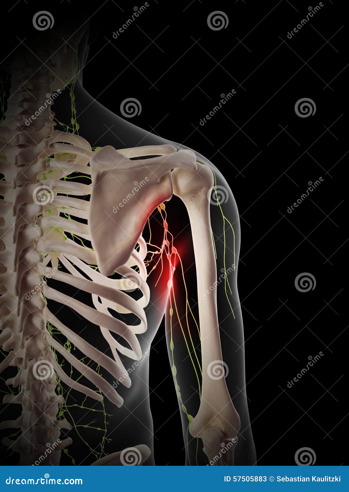 Painful Lymphatic Nodes Stock Illustration Illustration Of Arthrosis