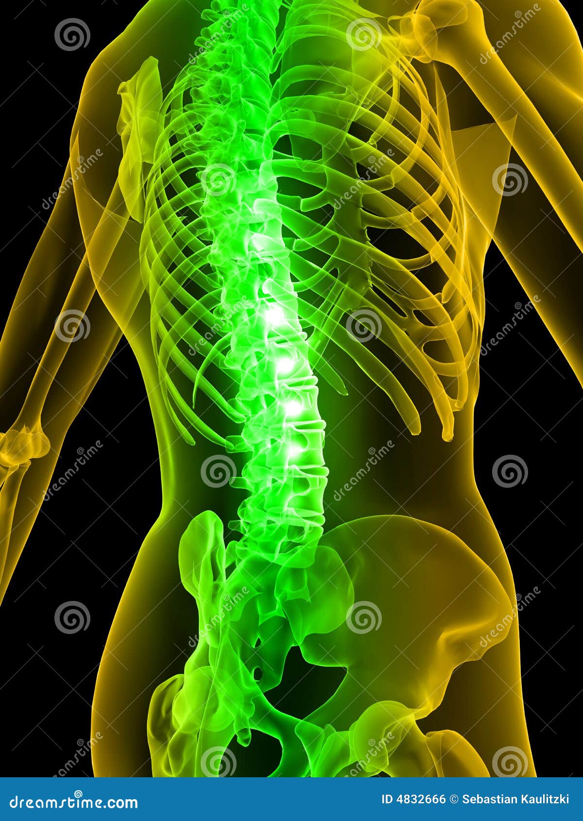 painful spine