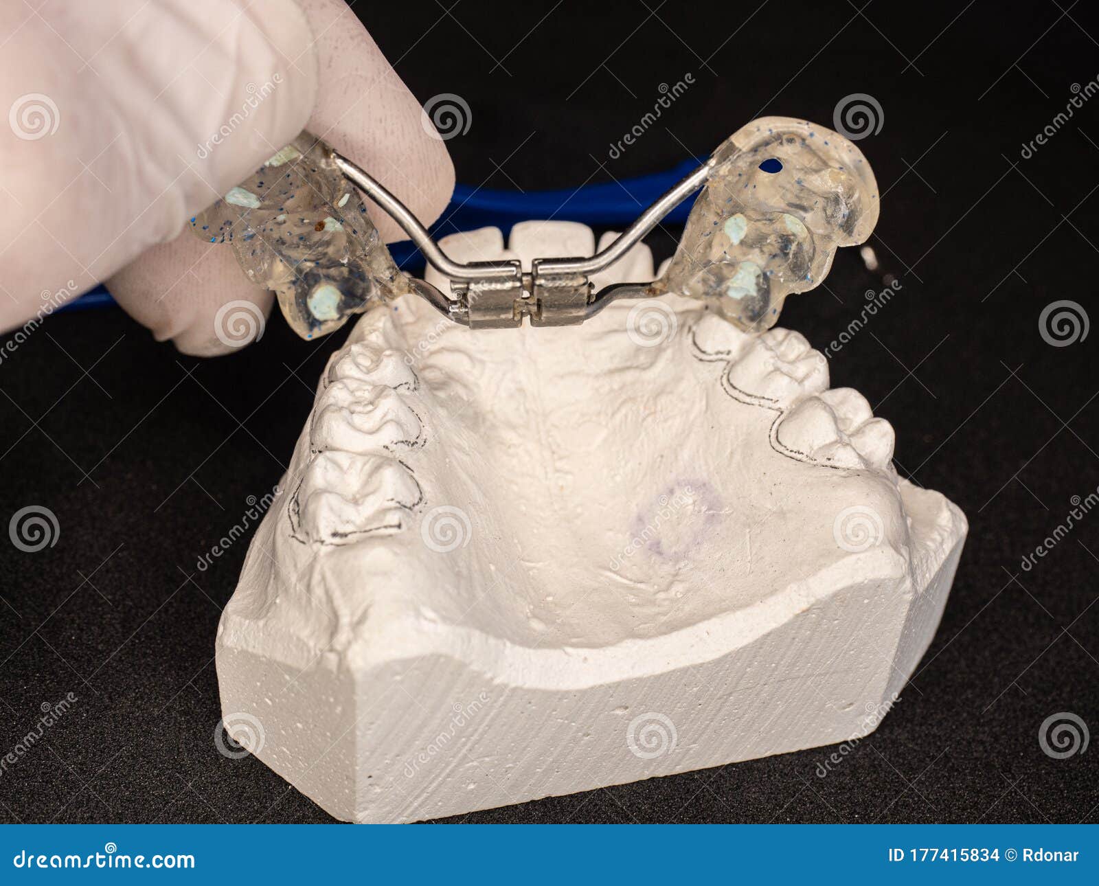 palatal expander for the maxilla, setting test