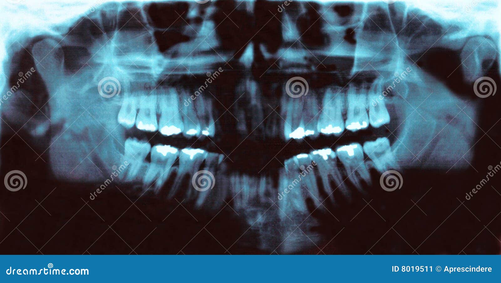panoramic dental radiology slide