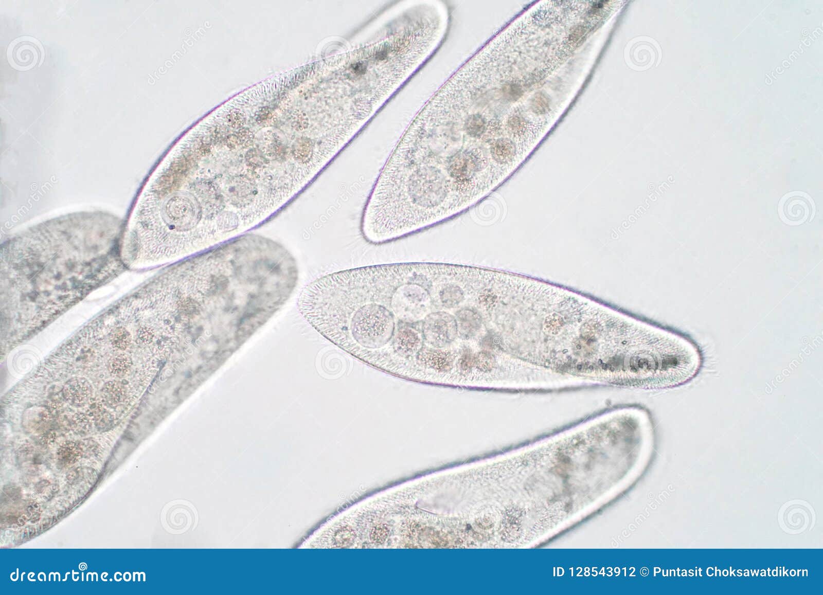 ciliates under microscope