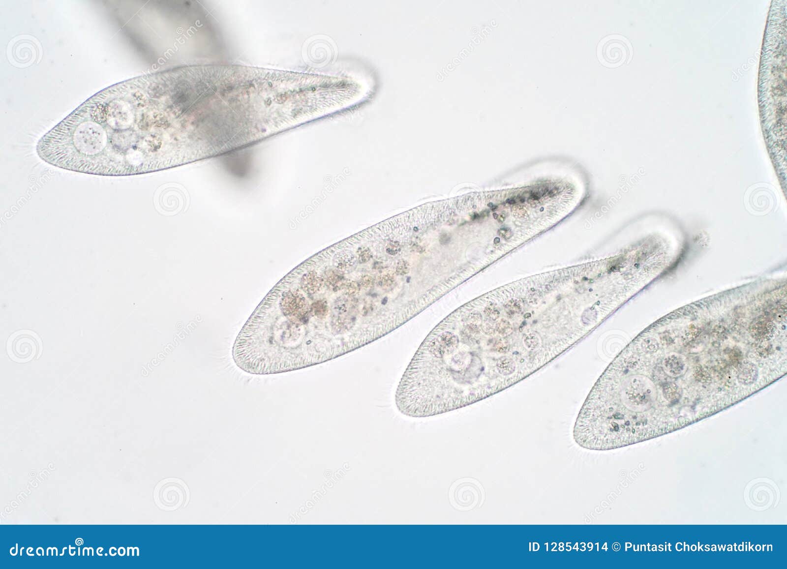 ciliates under microscope