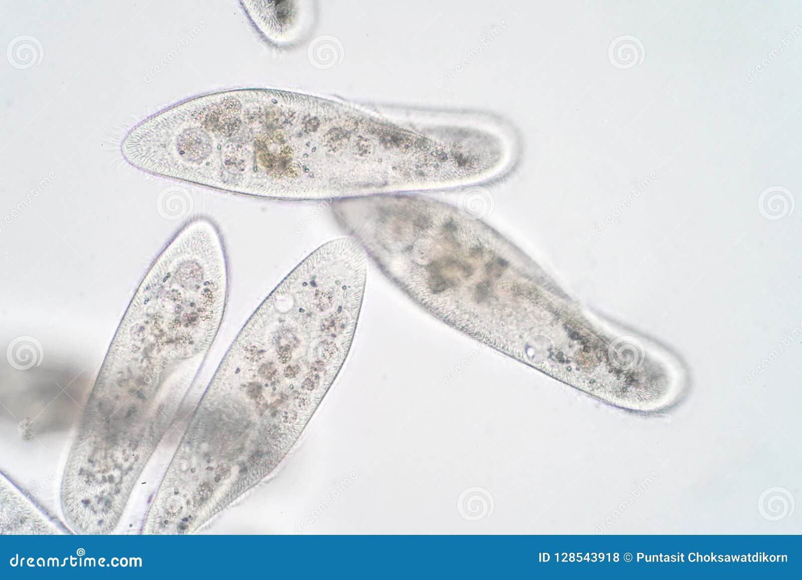 ciliates under microscope