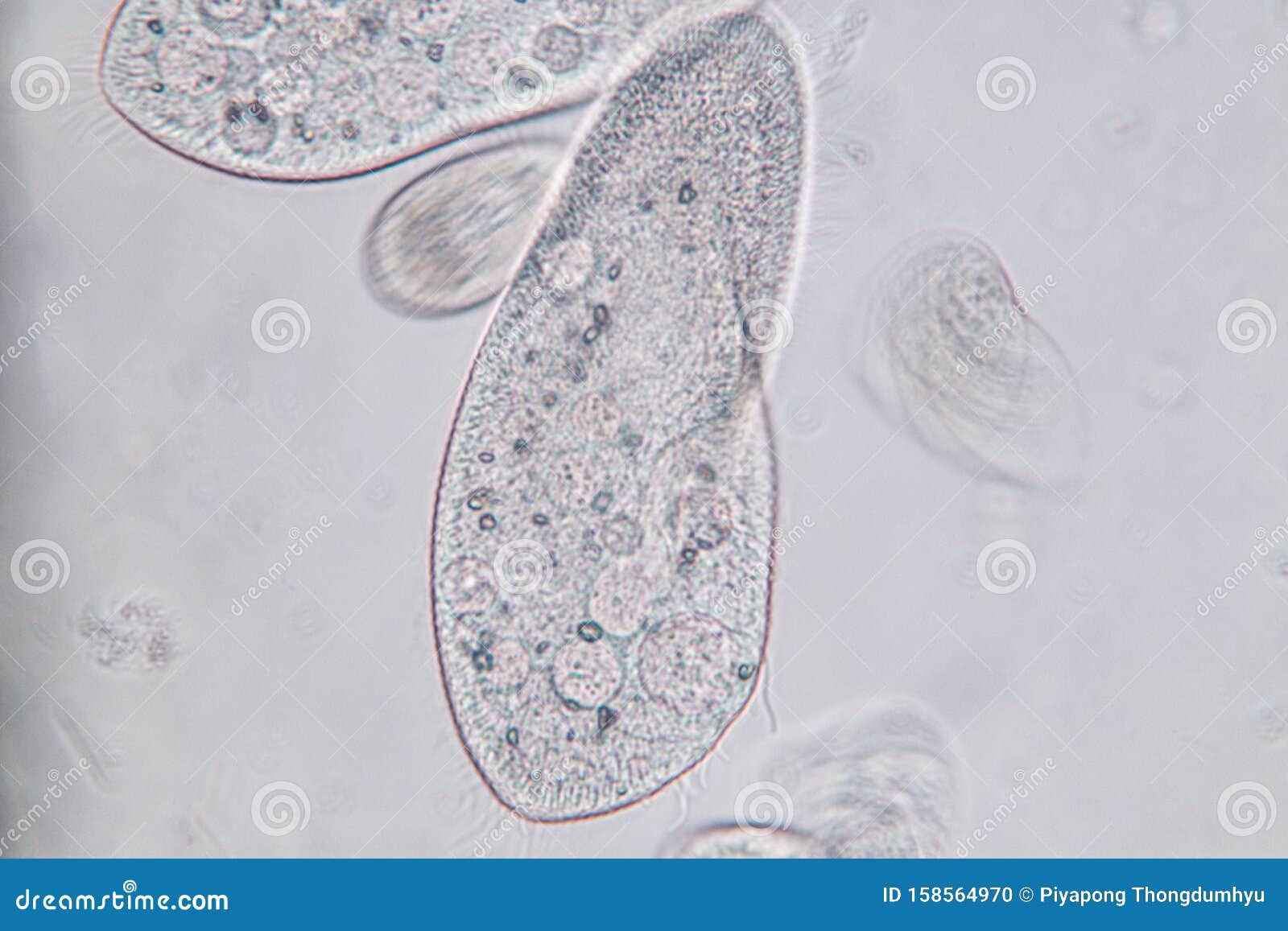 ciliates under microscope