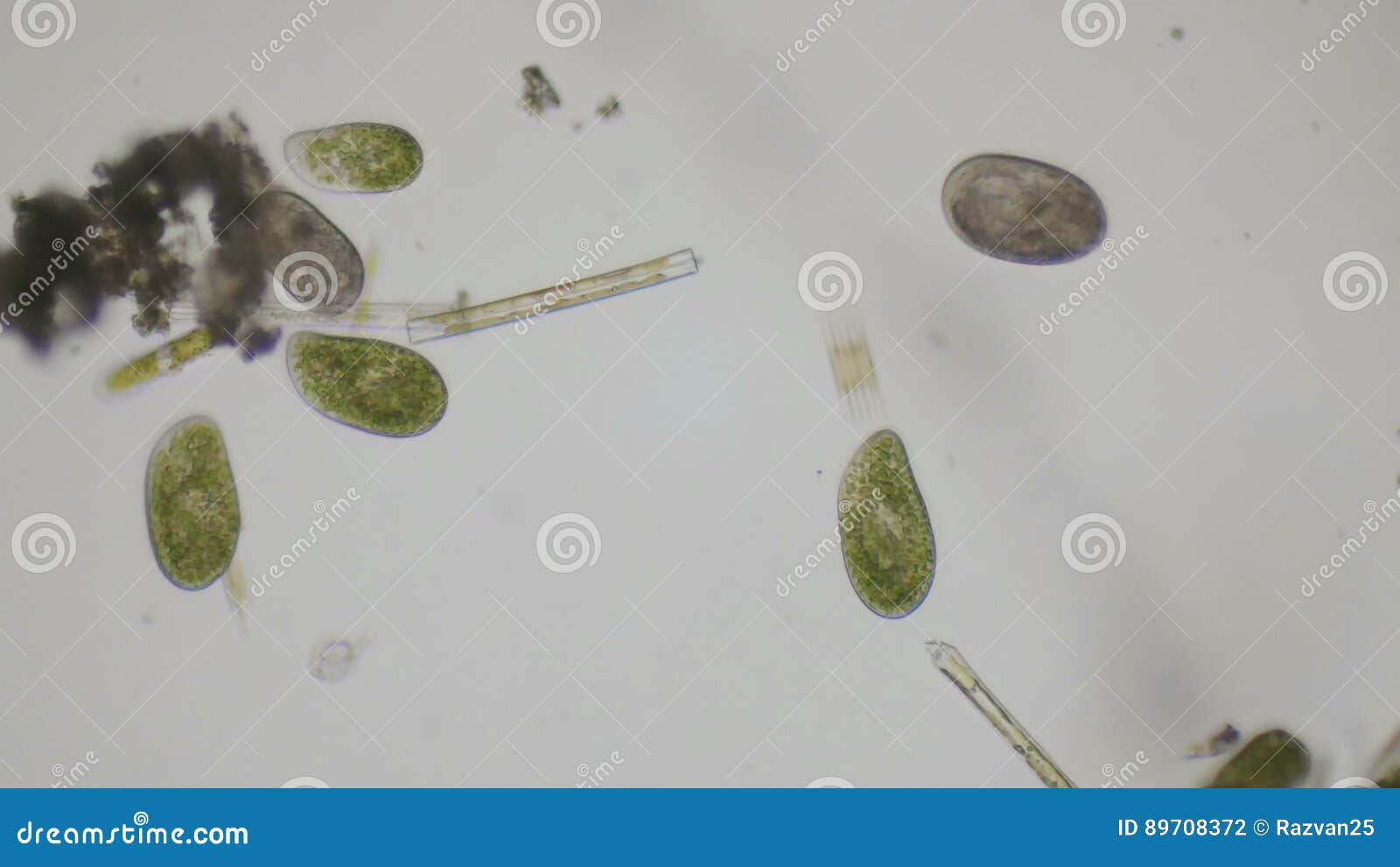 ciliates under microscope