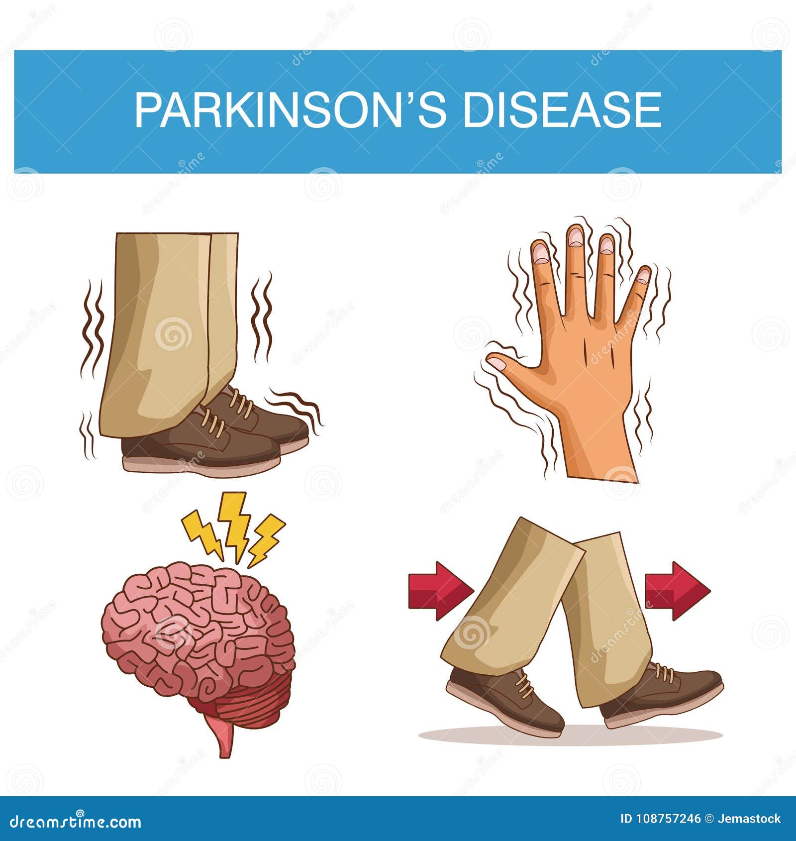 Parkinsons Certification prntbl concejomunicipaldechinu gov co Parkinsons Certification prntbl concejomunicipaldechinu gov co