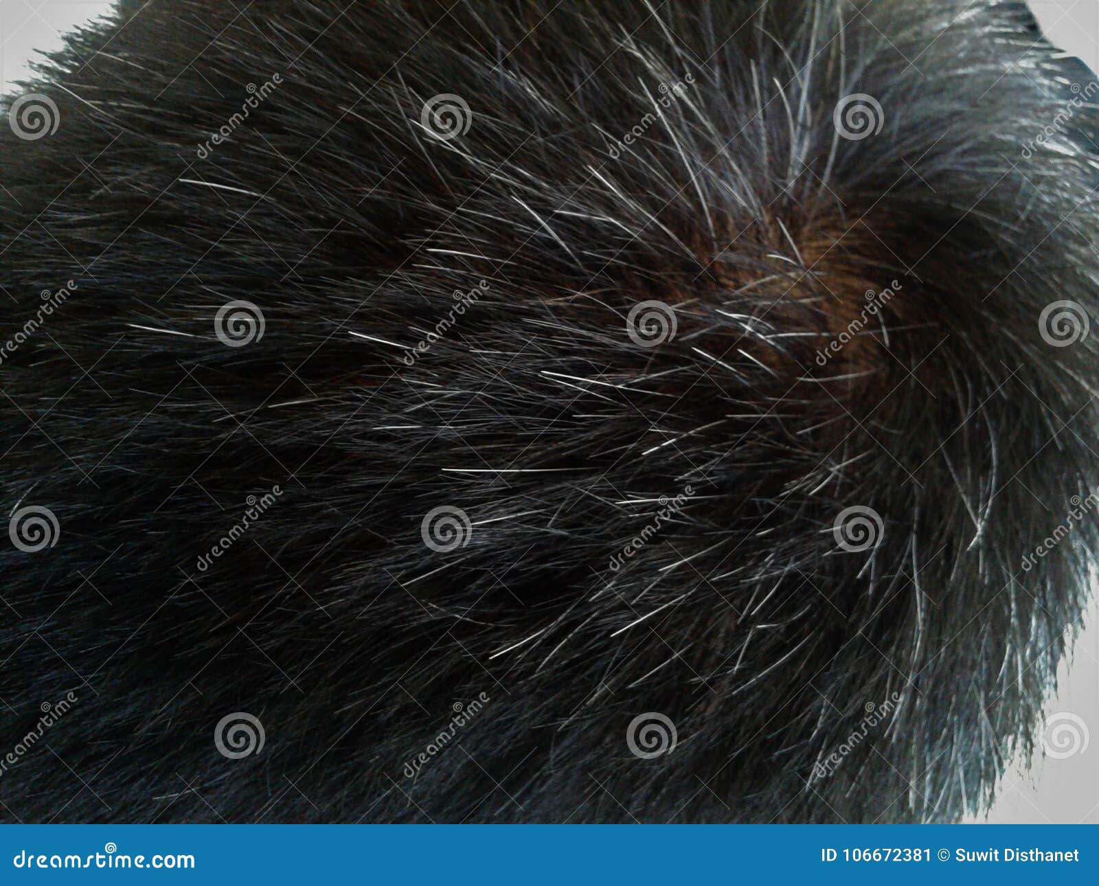 Partial White Hair Problem Stock Image Image Of Grayhair 106672381