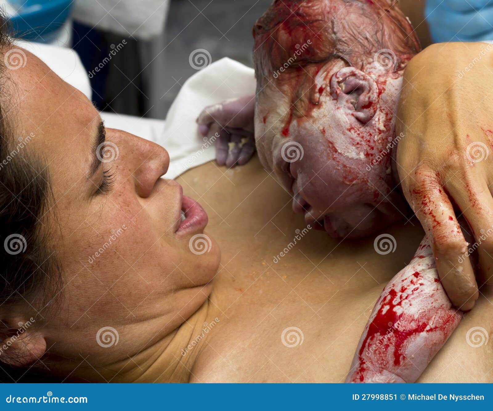 Newborn Baby After Birth Stock Photos & Newborn Baby After ...