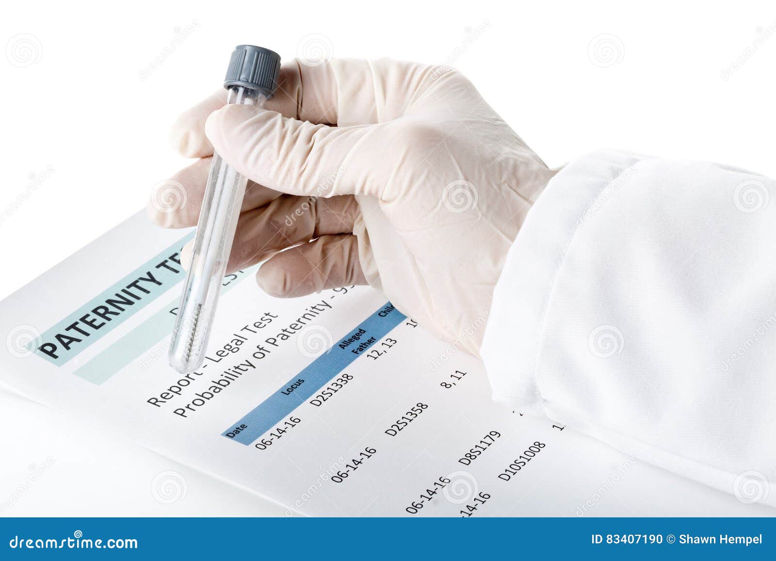 paternity test result form with doctor holding buccal swab in te