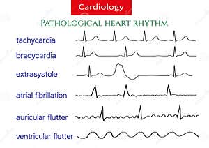 Pathological Ecg Collection Stock Illustration CartoonDealer 