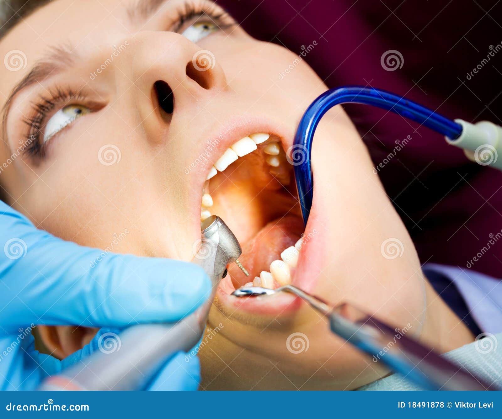 Patient pain dentist stock photo. Image of health, teeth 18491878
