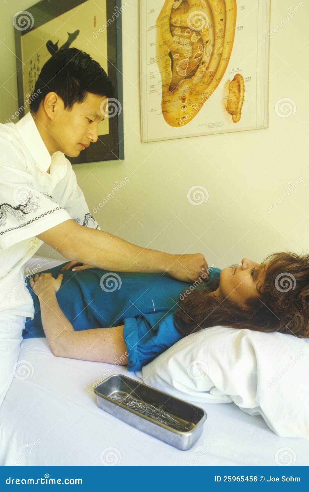 A Patient Receiving an Acupuncture Treatment, Editorial Stock Photo