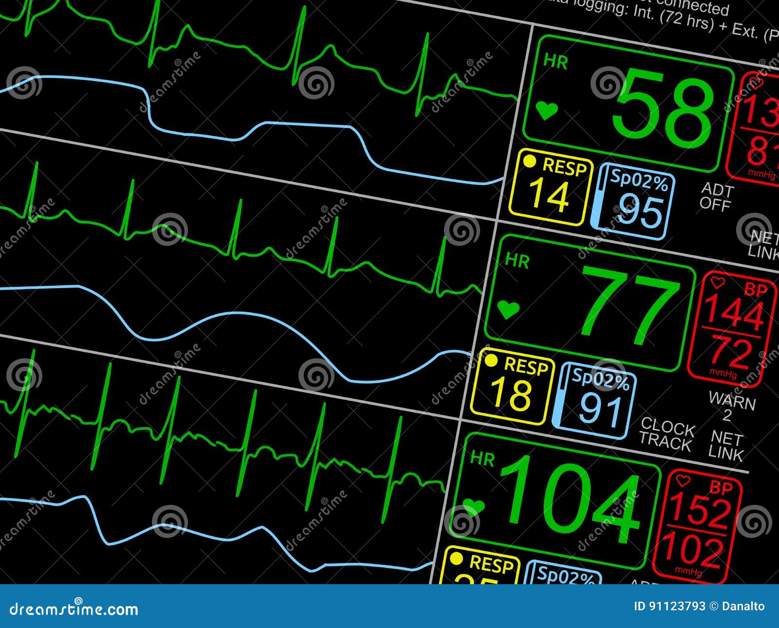 patient`s vital signs on icu monitor